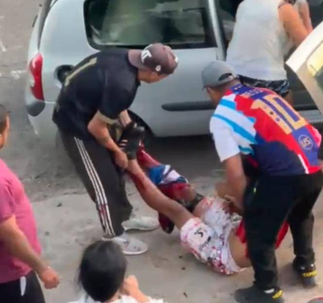 Lo atacaron en manada, perdió una pierna y su familia exige justicia en Los Hornos